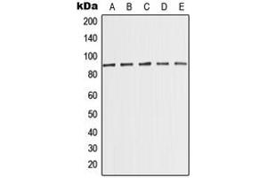 Western blot analysis of MED15 expression in MCF7 (A), K562 (B), HeLa (C), NIH3T3 (D), PC12 (E) whole cell lysates. (MED15 antibody  (Center))
