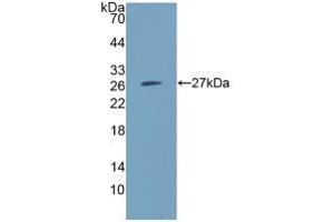 Western blot analysis of recombinant Human IGSF16. (CD300c antibody  (AA 21-183))
