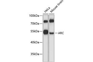 Western blot analysis of extracts of various cell lines, using ARC antibody (ABIN6131195, ABIN6137063, ABIN6137064 and ABIN6224919) at 1:3000 dilution. (ARC (AA 1-220) antibody)