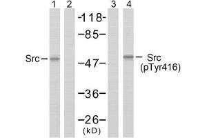 Western blot analysis of extracts from COLO205 cells using Src (Ab-418) antibody (E021115, Lane 1 and 2) and Src (phospho-Tyr418) antibody (E011091, Lane 3 and 4). (Src antibody)