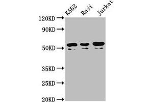 Western Blot Positive WB detected in: K562 whole cell lysate, Raji whole cell lysate, Jurkat whole cell lysate All lanes: TOX2 antibody at 4. (TOX2 antibody  (AA 303-417))