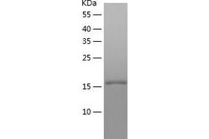 Western Blotting (WB) image for ADP-Ribosylation Factor-Like 2 Binding Protein (ARL2BP) (AA 1-163) protein (His tag) (ABIN7289476) (ARL2BP Protein (AA 1-163) (His tag))