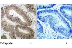 Image no. 1 for anti-conserved Helix-Loop-Helix Ubiquitous Kinase (CHUK) (pThr23) antibody (ABIN196837) (IKK alpha antibody  (pThr23))