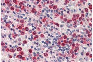 Human Spleen (formalin-fixed, paraffin-embedded) stained with ZBTB7A antibody ABIN337217 at 2. (ZBTB7A antibody  (C-Term))