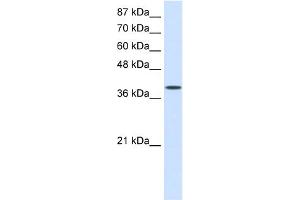 WB Suggested Anti-EIF4G2 Antibody Titration:  0. (EIF4G2 antibody  (C-Term))