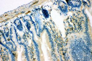 Anti- IRS1 antibody, IHC(P) IHC(P): Mouse Intestine Tissue (IRS1 antibody  (AA 1041-1242))
