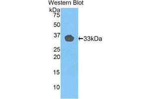 Western Blotting (WB) image for anti-Toll-Like Receptor 1 (TLR1) (AA 114-339) antibody (ABIN1175315) (TLR1 antibody  (AA 114-339))