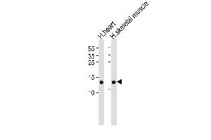 Western blot analysis of lysates from human heart and skeletal muscle tissue lysate(from left to right), using FABP3 Antibody (ABIN6242886 and ABIN6577405). (FABP3 antibody  (AA 1-133))