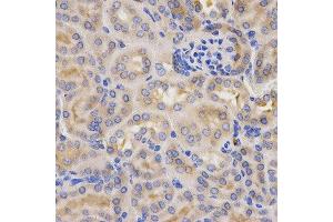 Immunohistochemistry of paraffin-embedded mouse kidney using CFB antibody at dilution of 1:200 (x400 lens) (Complement Factor B antibody  (AA 80-420))