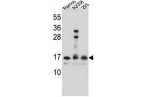 Western blot analysis of Homeodomain-only protein / HOP Antibody  in Ramos,A2058,293 cell line lysates (35ug/lane). (HOPX antibody  (C-Term))