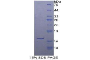 SDS-PAGE (SDS) image for Inhibin, beta A (INHBA) (AA 311-426) protein (His tag) (ABIN2121291) (INHBA Protein (AA 311-426) (His tag))