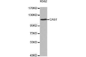 Western blot analysis of extracts of K562 cell line, using CAST antibody. (Calpastatin antibody  (C-Term))