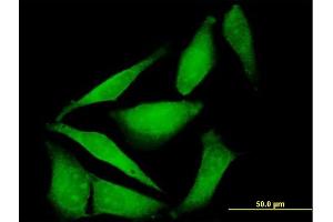Immunofluorescence of purified MaxPab antibody to FBXO40 on HeLa cell. (FBXO40 antibody  (AA 1-709))