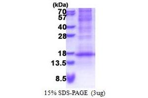 SDS-PAGE (SDS) image for Defensin, beta 116 (DEFB116) (AA 24-102) protein (His tag) (ABIN5778678)