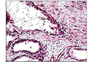 Human Prostate: Formalin-Fixed, Paraffin-Embedded (FFPE) (STEAP2 antibody  (AA 455-467))