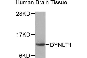 Western Blotting (WB) image for anti-Dynein, Light Chain, Tctex-Type 1 (DYNLT1) antibody (ABIN1872391)