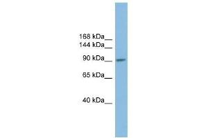 PIWIL2 antibody used at 1 ug/ml to detect target protein. (PIWIL2 antibody)