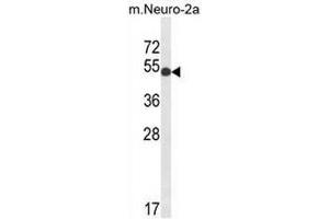 Western blot analysis of GPI Antibody (C-term) in mouse Neuro-2a cell lysates (35µg/lane). (GPI antibody  (C-Term))