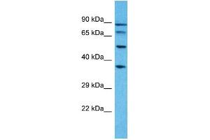 Western Blotting (WB) image for anti-Pseudouridylate Synthase 7 Homolog-Like (PUS7L) (N-Term) antibody (ABIN2791889) (PUS7L antibody  (N-Term))