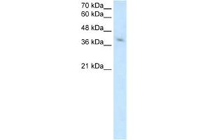 WB Suggested Anti-MICA Antibody Titration:  2. (MICA antibody  (Middle Region))