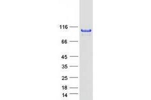 Western Blotting (WB) image for Active BCR-Related (ABR) (Transcript Variant 1) protein (Myc-DYKDDDDK Tag) (ABIN2714290)