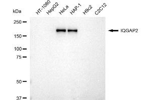 Western blotting analysis using IQGAP2 antibody (ABIN7799122).