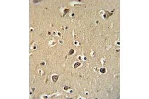 Immunohistochemistry analysis human brain tissue (Formalin-fixed, Paraffin-embedded) using PCDHGC3  Antibody , followed by peroxidase conjugation of the secondary antibody and DAB staining. (Protocadherin gamma Subfamily C, 3 (PCDHGC3) (AA 518-547), (Middle Region) antibody)