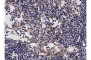 ABIN6266689 at 1/100 staining human Lymph node tissue sections by IHC-P. (TP53I11 antibody  (N-Term))