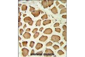 Formalin-fixed and paraffin-embedded human skeletal muscle reacted with PTPN11 Antibody (C-term), which was peroxidase-conjugated to the secondary antibody, followed by DAB staining. (PTPN11 antibody  (C-Term))