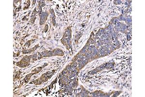 IHC analysis of MLX-interacting protein/MLXIP using anti-MLX-interacting protein/MLXIP antibody (ABIN7602593). (MLXIP antibody  (AA 88-348))