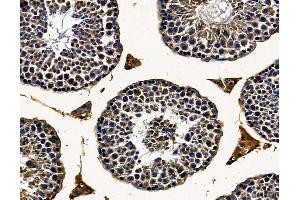 DHX32 Antibody at 1/100 staining mouse testis tissue by IHC-P.