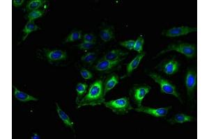 Immunofluorescent analysis of Hela cells using ABIN7173241 at dilution of 1:100 and Alexa Fluor 488-congugated AffiniPure Goat Anti-Rabbit IgG(H+L) (TMEM56 antibody  (AA 232-263))