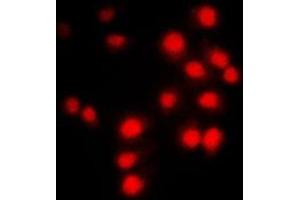 Immunofluorescent analysis of Cyclin A1/2 staining in NIH3T3 cells. (Cyclin-A1-2 antibody  (Center))