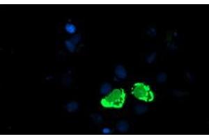 Anti-ENPEP mouse monoclonal antibody (ABIN2455323) immunofluorescent staining of COS7 cells transiently transfected by pCMV6-ENTRY ENPEP (RC210521). (ENPEP antibody)
