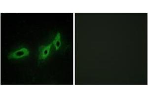 Immunofluorescence analysis of HeLa cells, using TRI18 Antibody. (MID1 antibody  (AA 71-120))