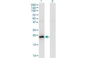 Western Blot analysis of BAALC expression in transfected 293T cell line by BAALC monoclonal antibody (M01), clone 2A2.