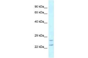 Western Blot showing RAB2A antibody used at a concentration of 1 ug/ml against MDA-MB-435S Cell Lysate (RAB2A antibody  (C-Term))