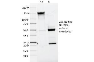 SDS-PAGE Analysis Purified MART-1 / Melan-A Mouse Monoclonal Antibody (A103).