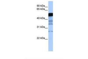 Image no. 1 for anti-E3 ubiquitin-protein ligase RAD18 (RAD18) (AA 197-246) antibody (ABIN6738067) (RAD18 antibody  (AA 197-246))