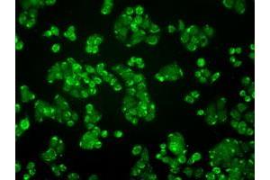 Immunofluorescent staining of HT29 cells using anti-ALDH2 mouse monoclonal antibody (ABIN2452752). (ALDH2 antibody)