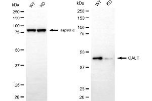 anti-Galactose-1-Phosphate Uridylyltransferase (GALT) antibody