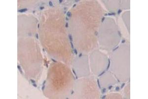 Figure. (Acetylcholinesterase antibody  (AA 367-549))