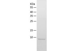 Western Blotting (WB) image for Ubiquitin-Like 3 (UBL3) (AA 1-114) protein (His tag) (ABIN7284715) (UBL3 Protein (AA 1-114) (His tag))