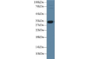 Detection of IGFBP1 in Porcine Liver lysate using Polyclonal Antibody to Insulin Like Growth Factor Binding Protein 1 (IGFBP1) (IGFBPI antibody  (AA 112-262))