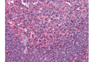Immunohistochemical analysis of paraffin-embedded human Tonsil tissues using anti-CD80 mAb (CD80 antibody)