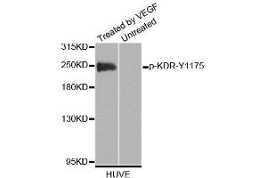 Western blot analysis of extracts of HUVE cells, using Phospho-KDR-Y1175 antibody (ABIN2988109). (VEGFR2/CD309 antibody  (pTyr1175))