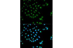 Immunofluorescence analysis of MCF-7 cells using XRCC2 antibody (ABIN5970910). (XRCC2 antibody)
