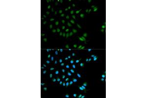 Immunofluorescence analysis of MCF-7 cells using XRCC2 antibody (ABIN5970910). (XRCC2 antibody)