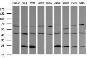 Parvin alpha antibody