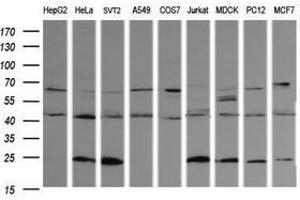 Image no. 6 for anti-Parvin, alpha (PARVA) antibody (ABIN1496442) (Parvin alpha antibody)